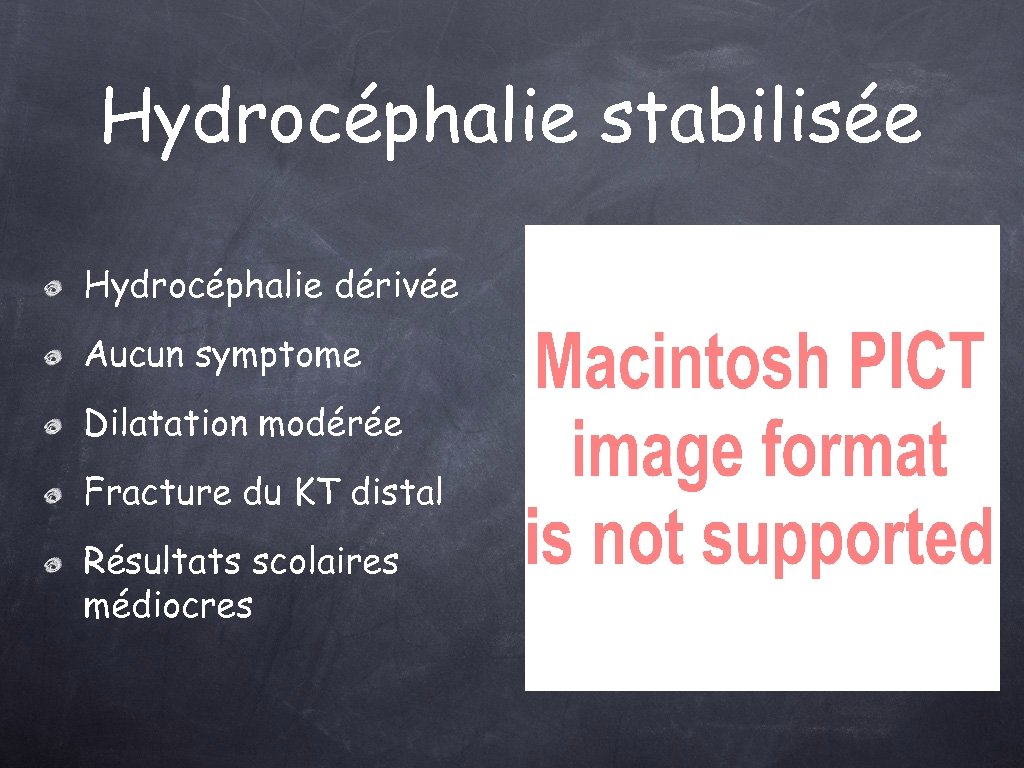 Hydrocéphalie stabilisée Hydrocéphalie dérivée Aucun symptome Dilatation modérée Fracture du KT distal Résultats scolaires