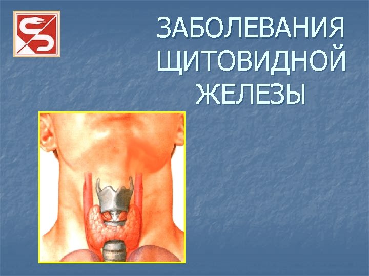 ЗАБОЛЕВАНИЯ ЩИТОВИДНОЙ ЖЕЛЕЗЫ 