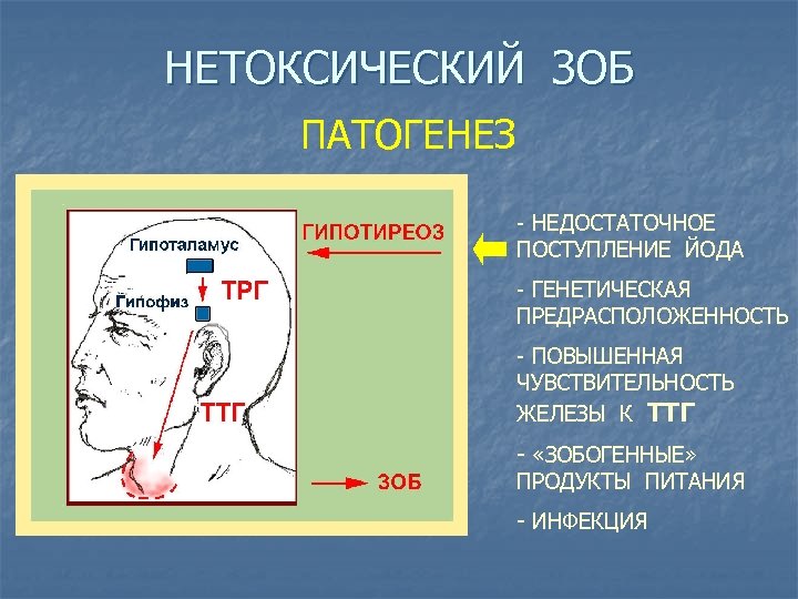 НЕТОКСИЧЕСКИЙ ЗОБ ПАТОГЕНЕЗ - НЕДОСТАТОЧНОЕ ПОСТУПЛЕНИЕ ЙОДА - ГЕНЕТИЧЕСКАЯ ПРЕДРАСПОЛОЖЕННОСТЬ - ПОВЫШЕННАЯ ЧУВСТВИТЕЛЬНОСТЬ ЖЕЛЕЗЫ