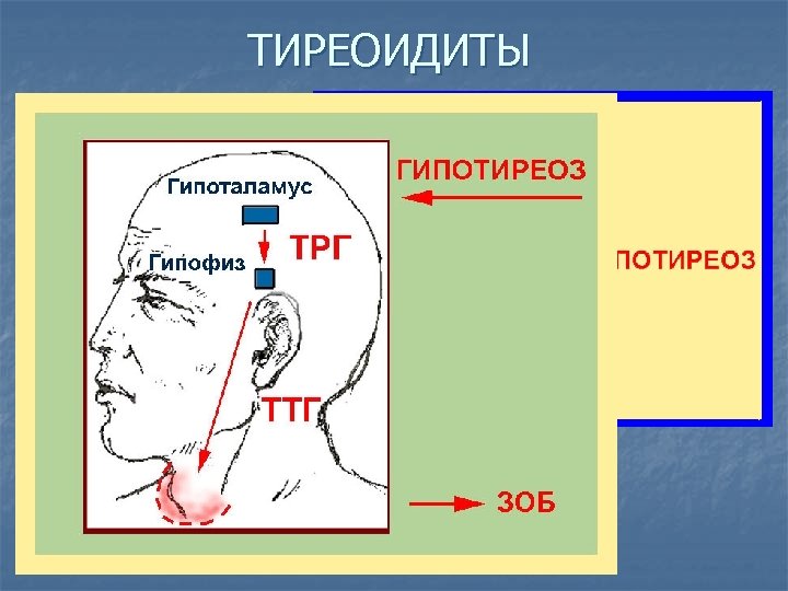 ТИРЕОИДИТЫ ПАТОГЕНЕЗ ОСТРЫЙ ТИРЕОИДИТ (СТРУМИТ) АУТОИММУННОГО ПОДОСТРЫЙ ТИРЕОИДИТ ДЕ КЕРВЕНА ТИРЕОИДИТ РИДЕЛЯ АУТОИММУННЫЙ ТИРЕОИДИТ