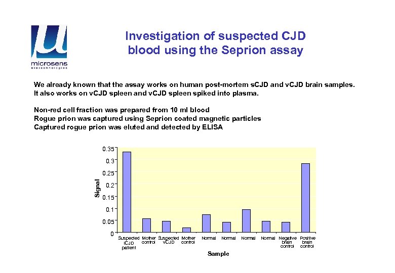 Investigation of suspected CJD blood using the Seprion assay We already known that the