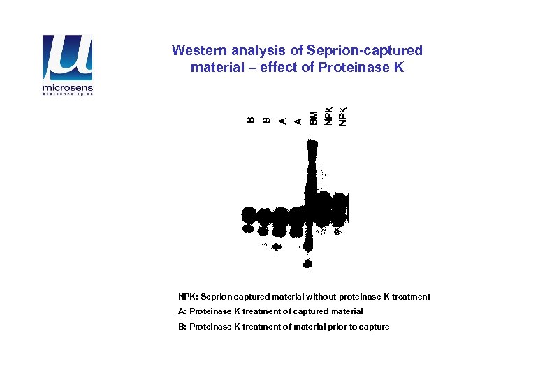 Western analysis of Seprion-captured material – effect of Proteinase K NPK: Seprion captured material
