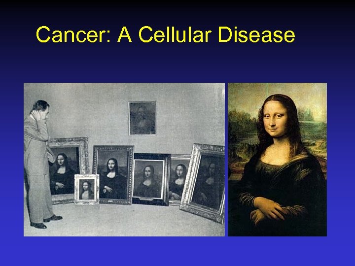 Cancer: A Cellular Disease 