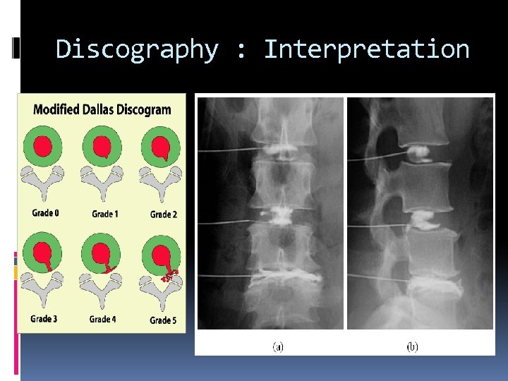 Discography : Interpretation 