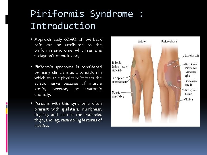 Piriformis Syndrome : Introduction • Approximately 6%-8% of low back pain can be attributed