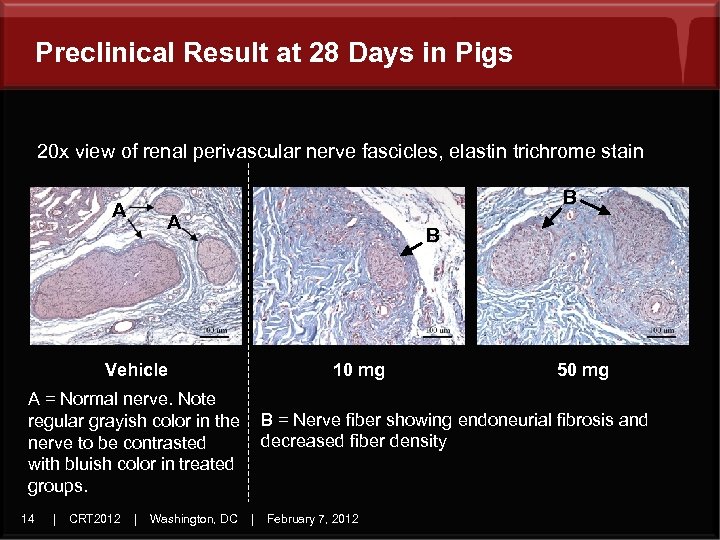 Preclinical Result at 28 Days in Pigs 20 x view of renal perivascular nerve