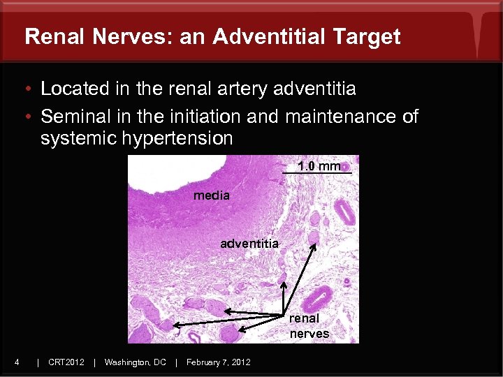 Renal Nerves: an Adventitial Target • Located in the renal artery adventitia • Seminal