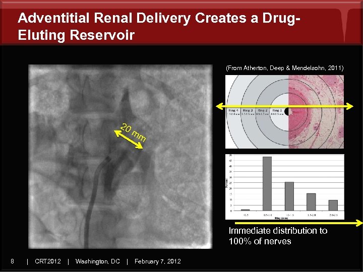 Adventitial Renal Delivery Creates a Drug. Eluting Reservoir (From Atherton, Deep & Mendelsohn, 2011)