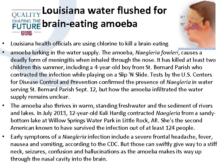 Louisiana water flushed for brain-eating amoeba • Louisiana health officials are using chlorine to