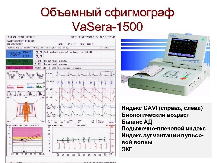 Объемный сфигмограф Va. Sera-1500 Индекс CAVI (справа, слева) Биологический возраст Баланс АД Лодыжечно-плечевой индекс