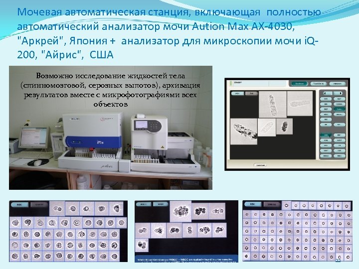 Мочевая автоматическая станция, включающая полностью автоматический анализатор мочи Aution Max АХ-4030, "Аркрей", Япония +