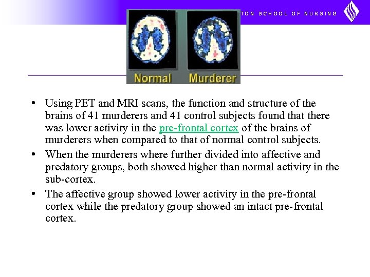 UNIVERSITY OF WASHINGTON SCHOOL OF NURSING • Using PET and MRI scans, the function