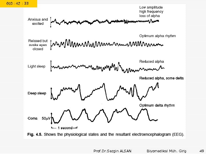 Prof. Dr. Sezgin ALSAN Biyomedikal Müh. Giriş 49 