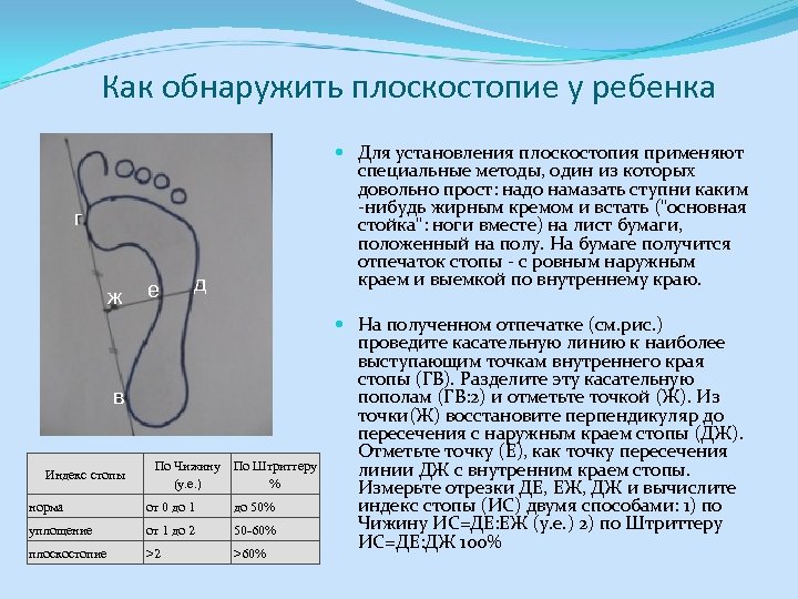 Как обнаружить плоскостопие у ребенка Для установления плоскостопия применяют специальные методы, один из которых