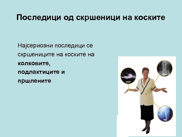 Последици од скршеници на коските Најсериозни последици се скршениците на коските на колковите, подлактиците
