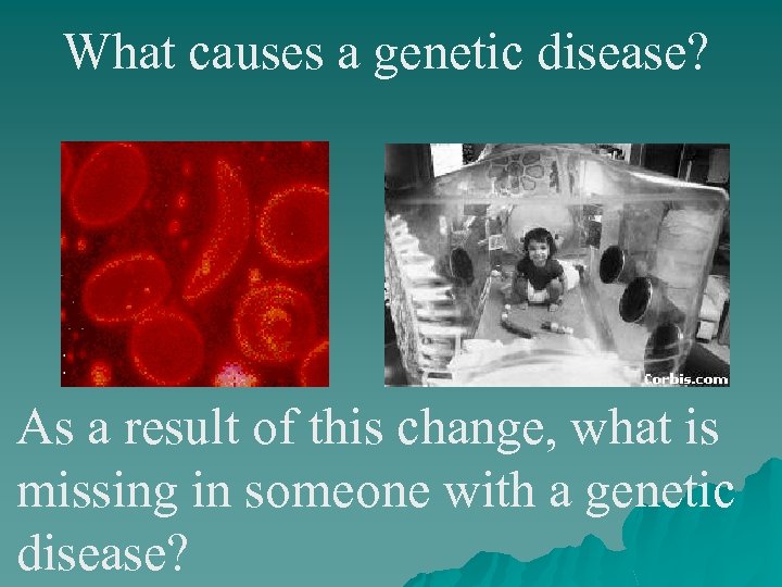 What causes a genetic disease? As a result of this change, what is missing