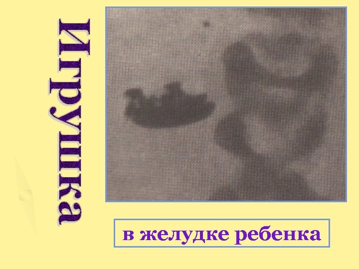 в желудке ребенка 