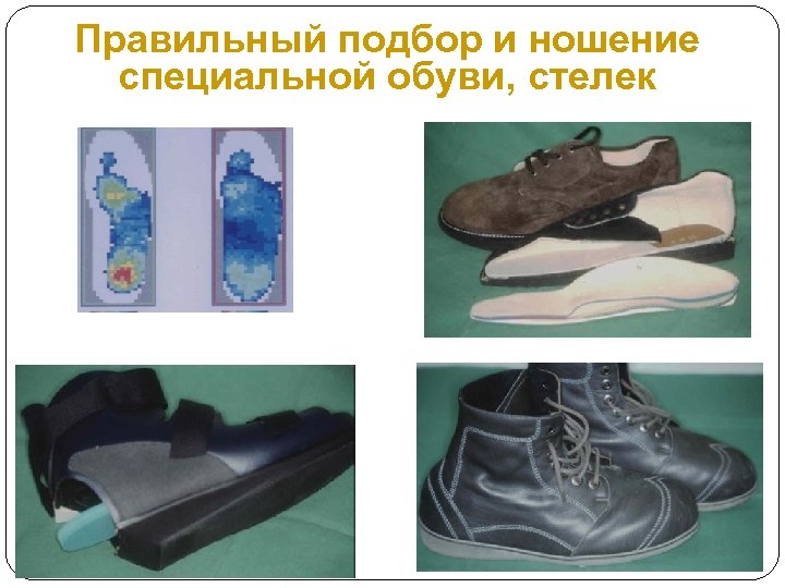 Правильный подбор и ношение специальной обуви, стелек 
