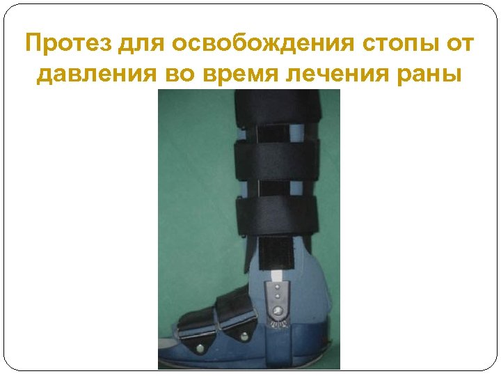 Протез для освобождения стопы от давления во время лечения раны 