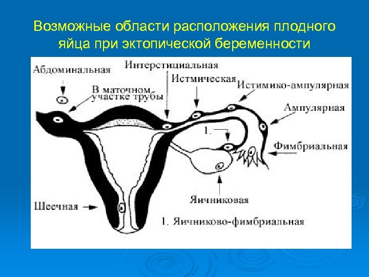 Маточная труба человека