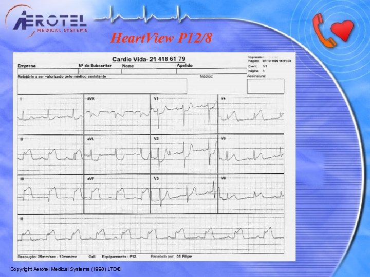 Heart. View P 12/8 Copyright Aerotel Medical Systems (1998) LTD© 