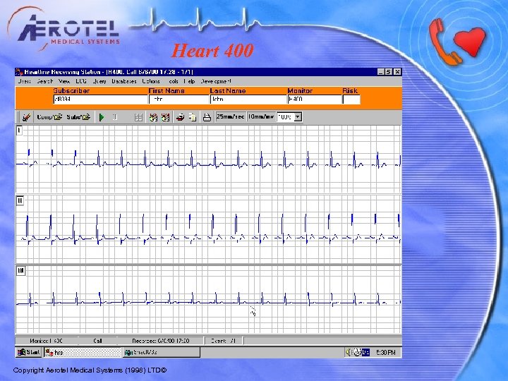 Heart 400 Copyright Aerotel Medical Systems (1998) LTD© 