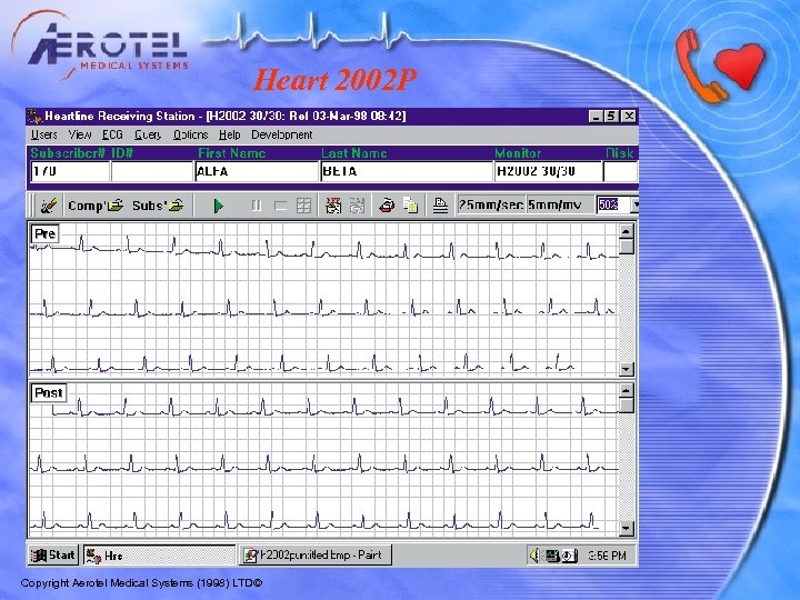 Heart 2002 P Copyright Aerotel Medical Systems (1998) LTD© 