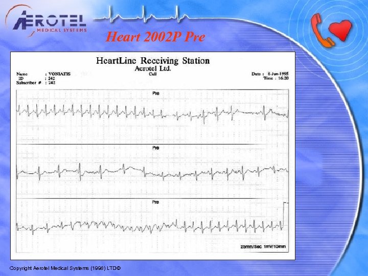 Heart 2002 P Pre Copyright Aerotel Medical Systems (1998) LTD© 