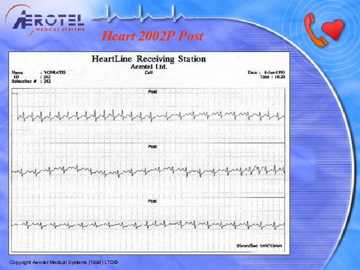 Heart 2002 P Post Copyright Aerotel Medical Systems (1998) LTD© 