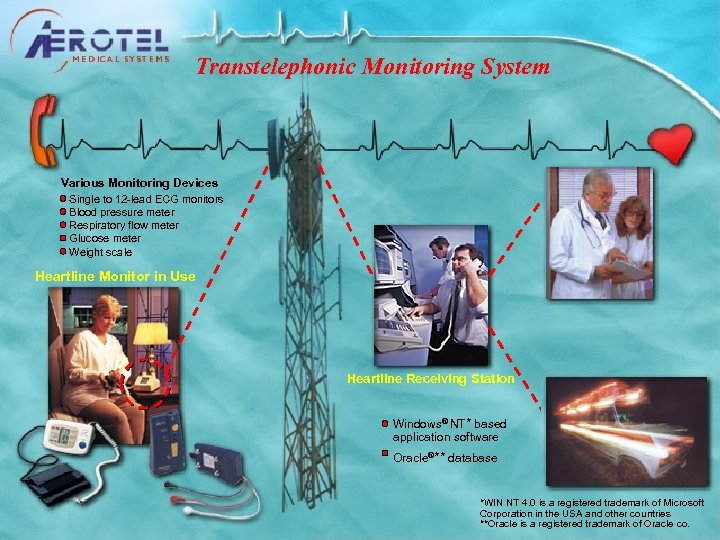 Transtelephonic Monitoring System Various Monitoring Devices Single to 12 -lead ECG monitors Blood pressure