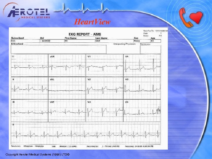 Heart. View Copyright Aerotel Medical Systems (1998) LTD© 