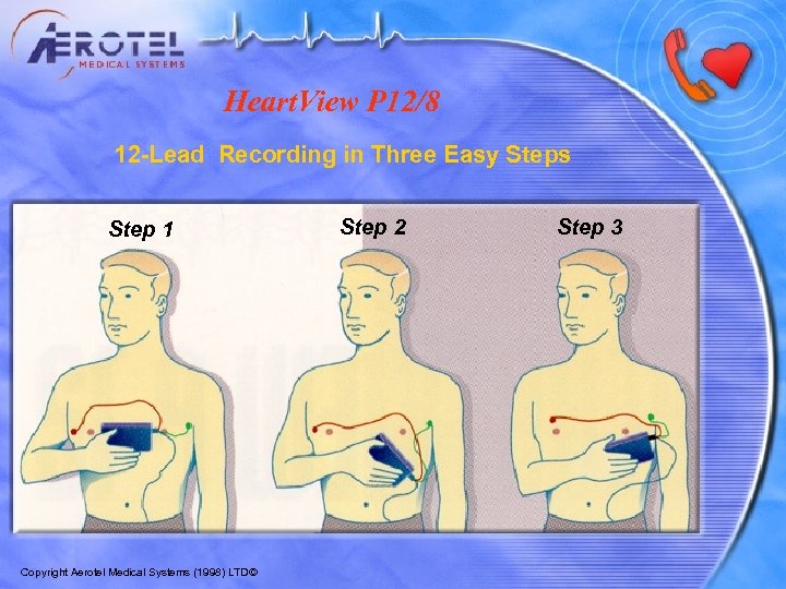 Heart. View P 12/8 12 -Lead Recording in Three Easy Steps Step 1 Copyright