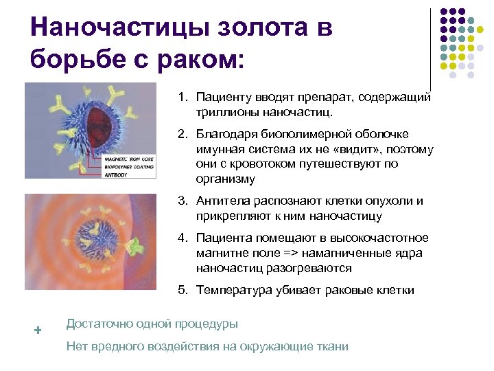 Наночастицы золота в борьбе с раком: 1. Пациенту вводят препарат, содержащий триллионы наночастиц. 2.