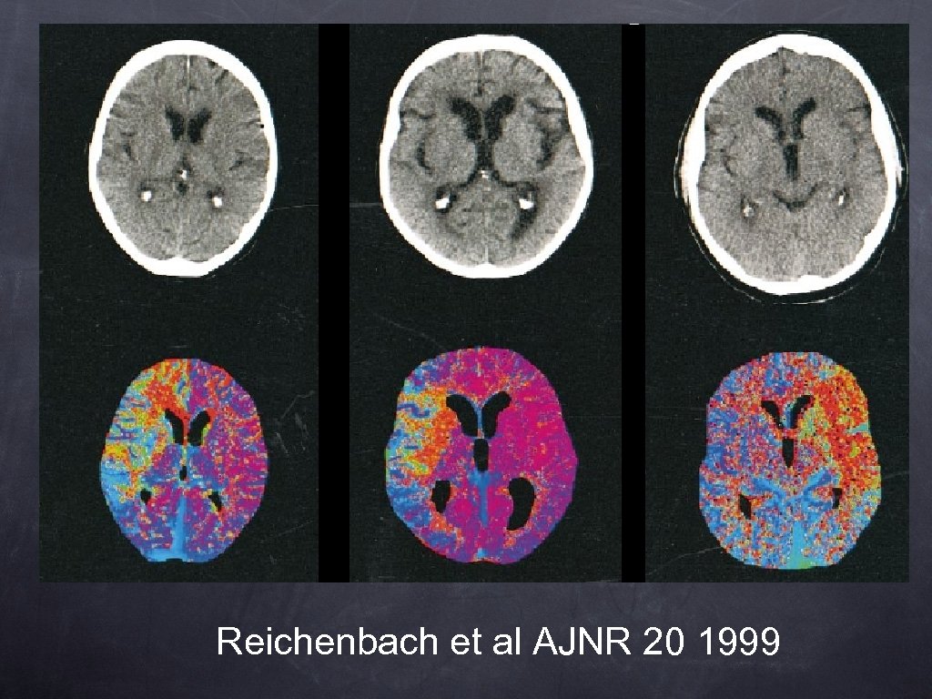 Reichenbach et al AJNR 20 1999 