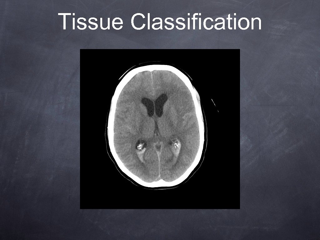 Tissue Classification 