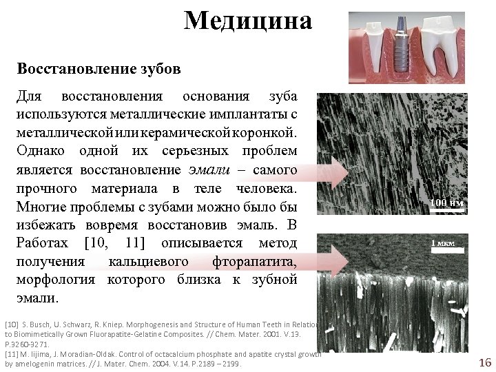 Медицина Восстановление зубов Для восстановления основания зуба используются металлические имплантаты с металлической или керамической