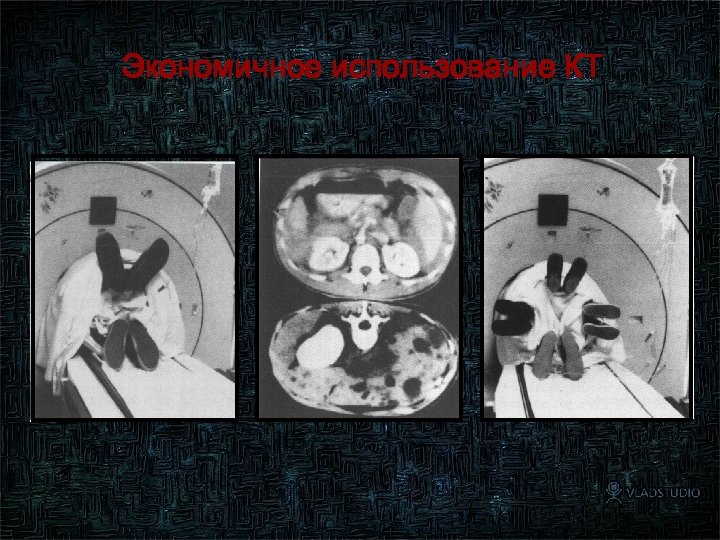 Экономичное использование КТ 