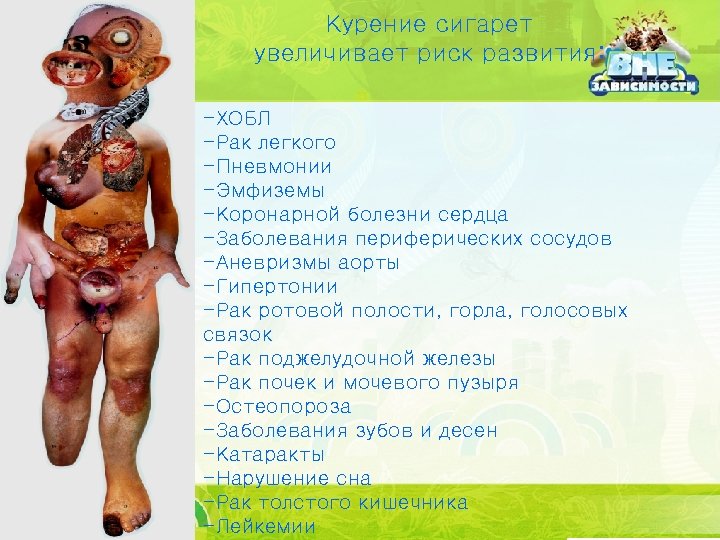 Курение сигарет увеличивает риск развития: -ХОБЛ -Рак легкого -Пневмонии -Эмфиземы -Коронарной болезни сердца -Заболевания