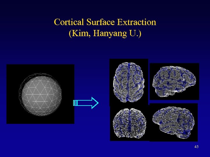 Cortical Surface Extraction (Kim, Hanyang U. ) 45 
