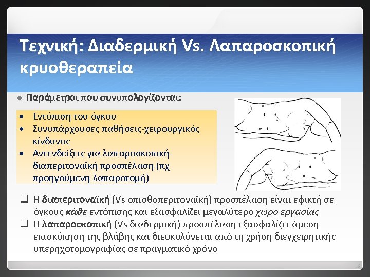 Τεχνική: Διαδερμική Vs. Λαπαροσκοπική κρυοθεραπεία l Παράμετροι που συνυπολογίζονται: Εντόπιση του όγκου Συνυπάρχουσες παθήσεις-χειρουργικός