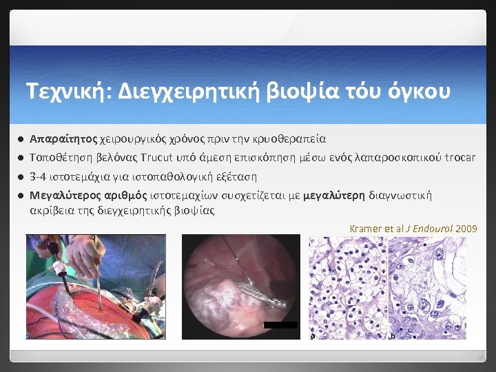 Τεχνική: Διεγχειρητική βιοψία τόυ όγκου l Απαραίτητος χειρουργικός χρόνος πριν την κρυοθεραπεία l Τοποθέτηση