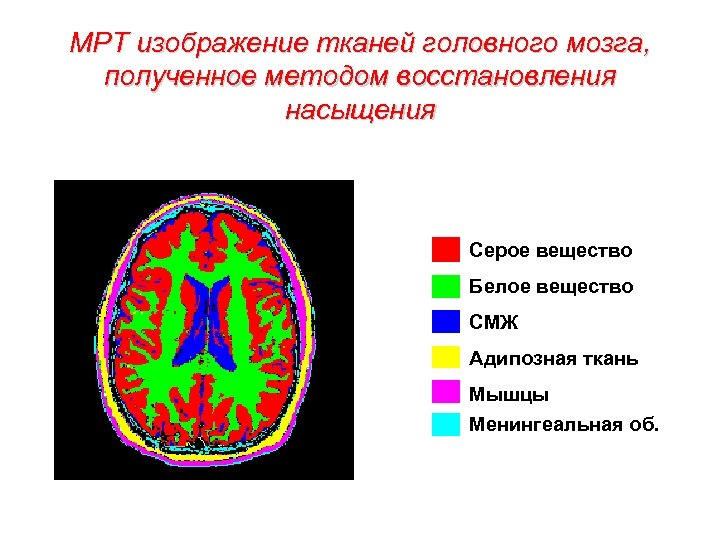 МРТ изображение тканей головного мозга, полученное методом восстановления насыщения Серое вещество Белое вещество СМЖ