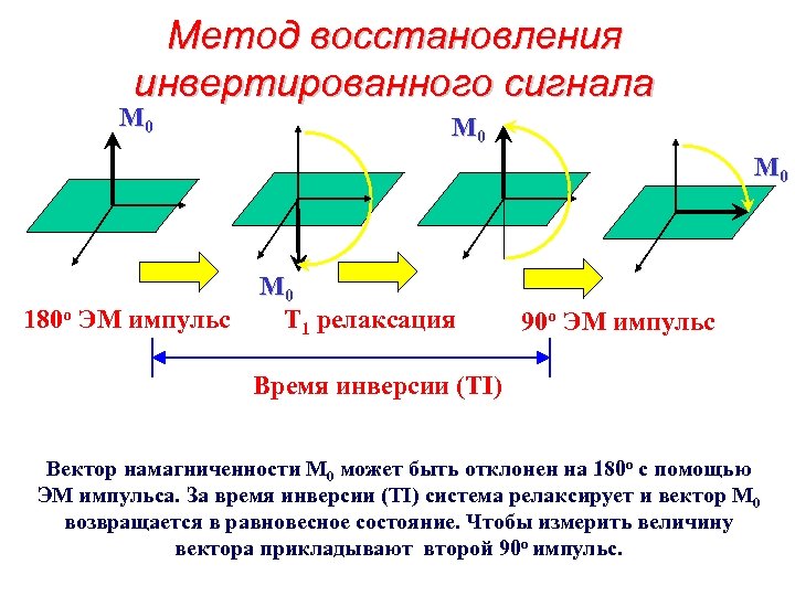 Метод восстановления инвертированного сигнала M 0 M 0 y x 180 o ЭМ импульс