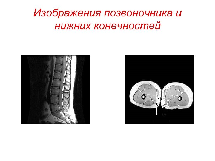 Изображения позвоночника и нижних конечностей 