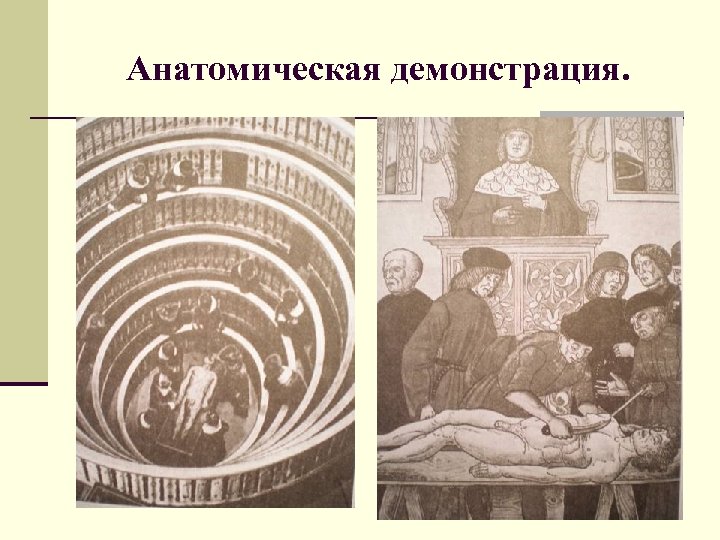 Анатомическая демонстрация. 