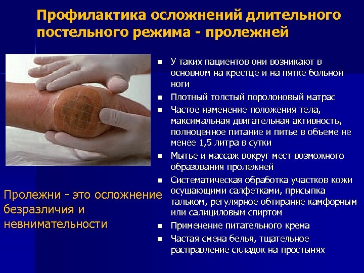 Профилактика осложнений длительного постельного режима - пролежней n n n Пролежни - это осложнение