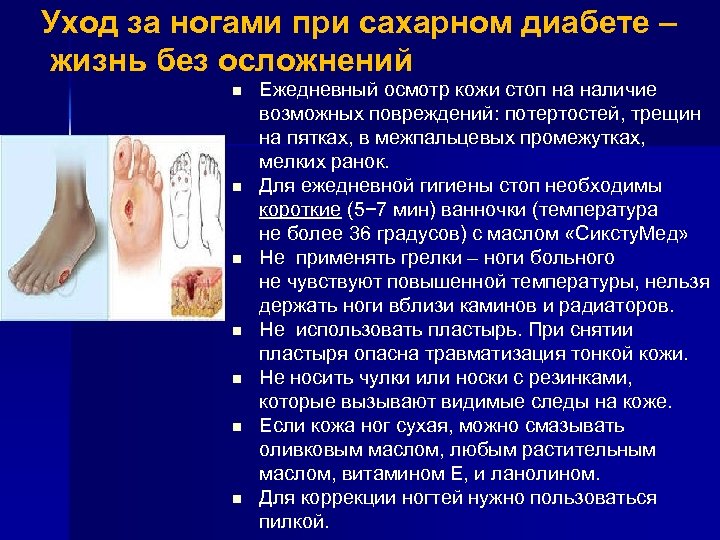 Уход за ногами при сахарном диабете – жизнь без осложнений n n n n