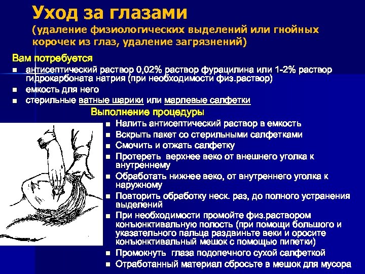Уход за глазами (удаление физиологических выделений или гнойных корочек из глаз, удаление загрязнений) Вам