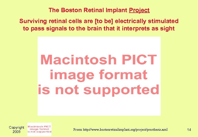 The Boston Retinal Implant Project Surviving retinal cells are [to be] electrically stimulated to