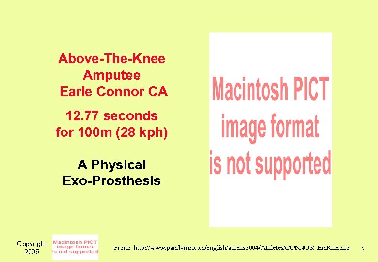 Above-The-Knee Amputee Earle Connor CA 12. 77 seconds for 100 m (28 kph) A